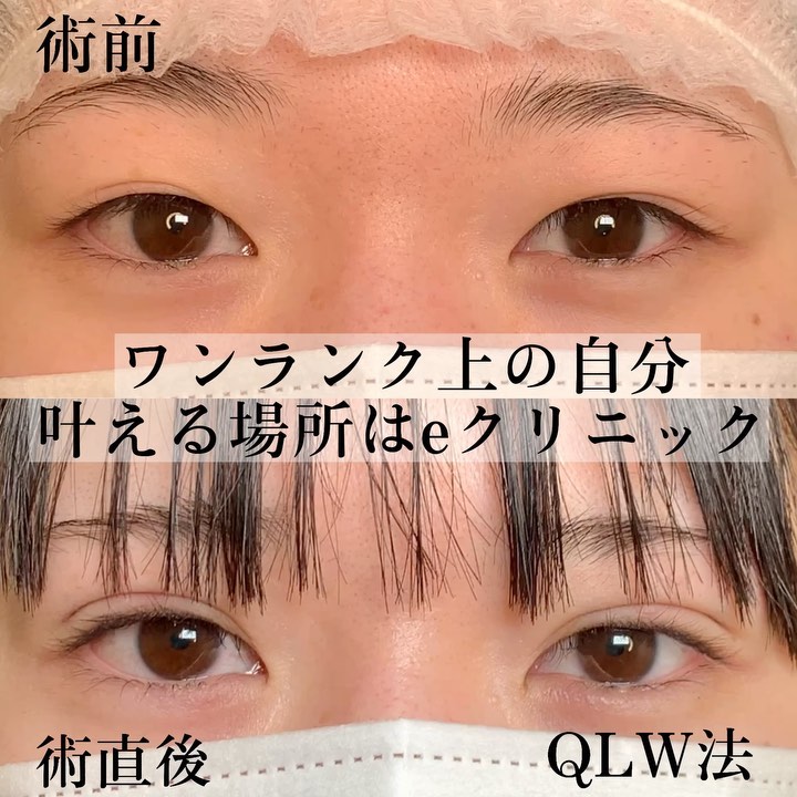 QLW