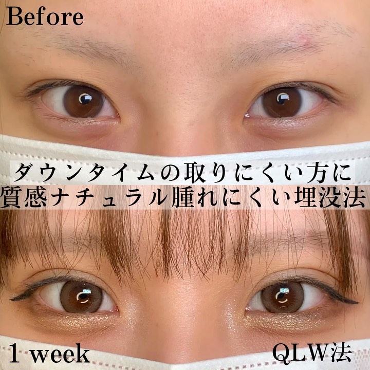 QLW