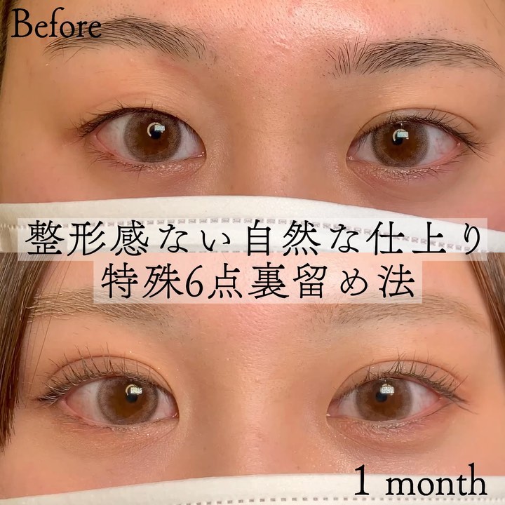 特殊6点裏留め