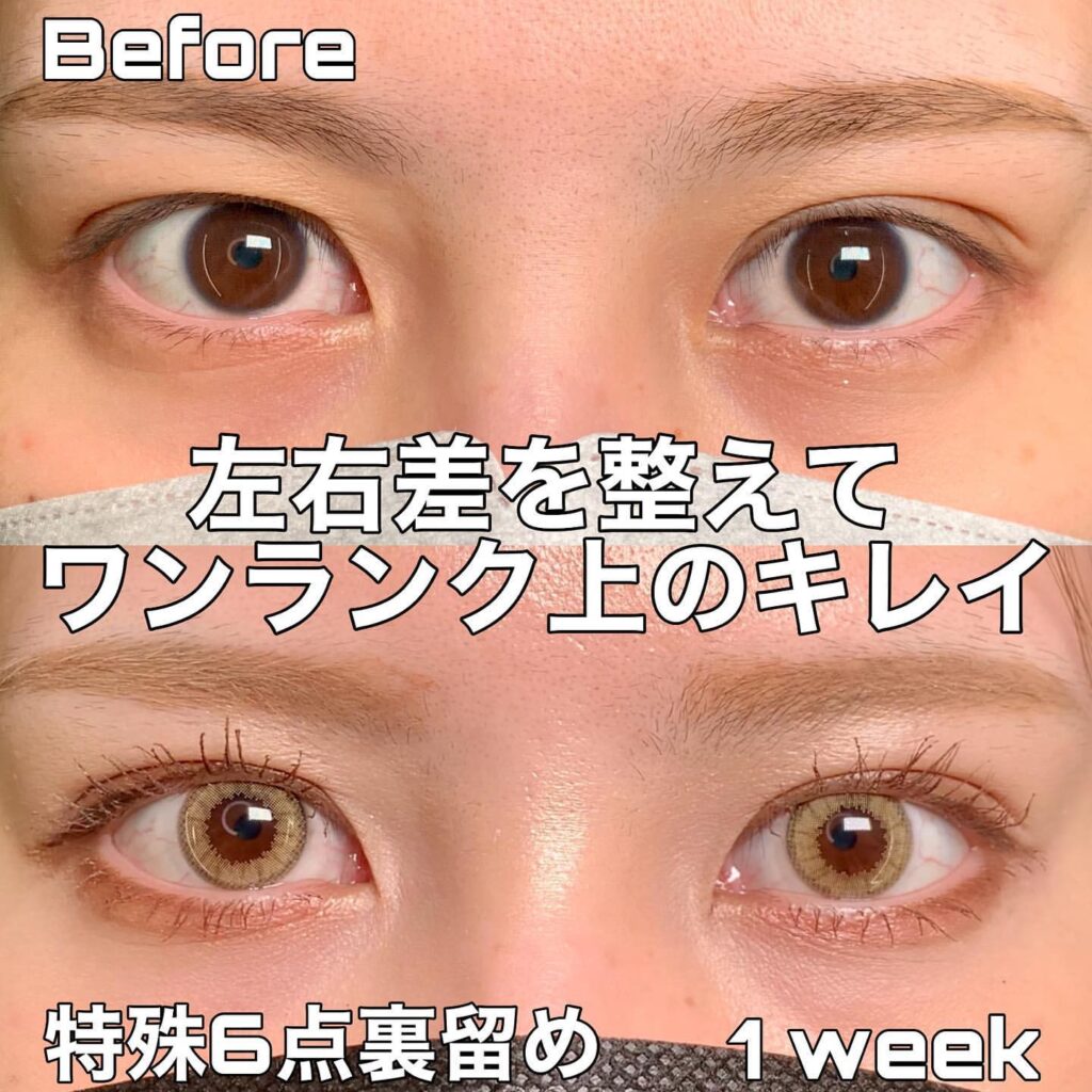 特殊6点裏留め