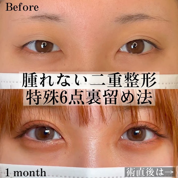 特殊6点裏留め