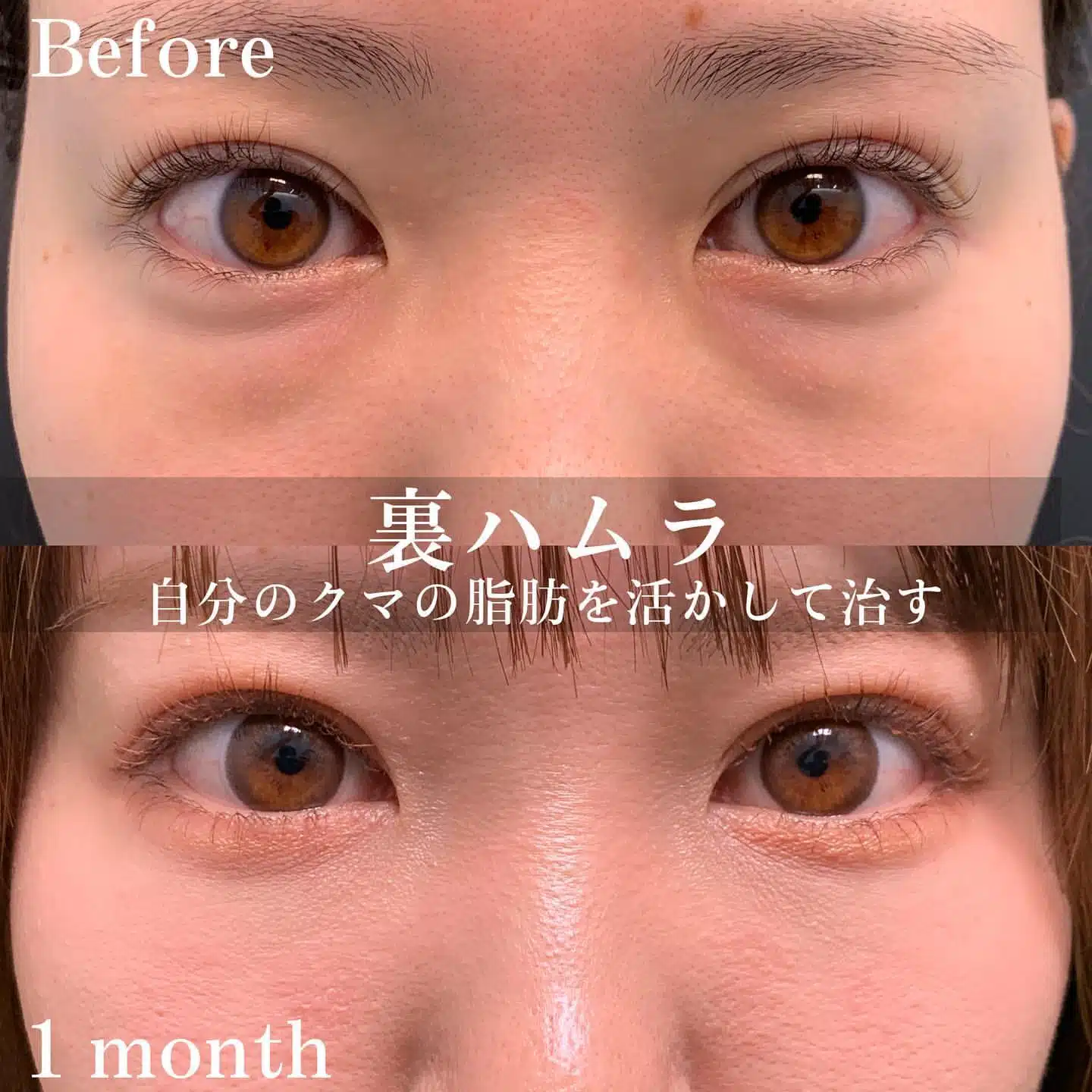 裏ハムラ