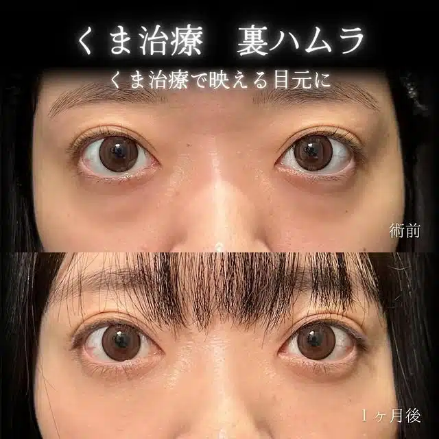 クマ取り　裏ハムラ　横浜みなとみらい