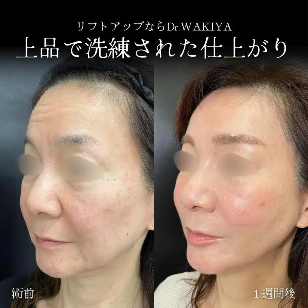 上品で洗練された仕上がり 横浜みなとみらい