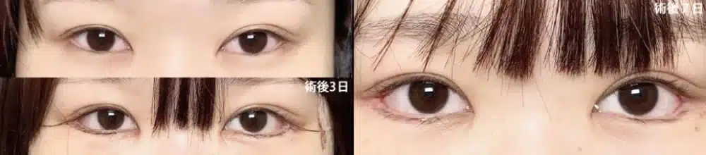 白目の露出を広げるデザイン 横浜みなとみらい