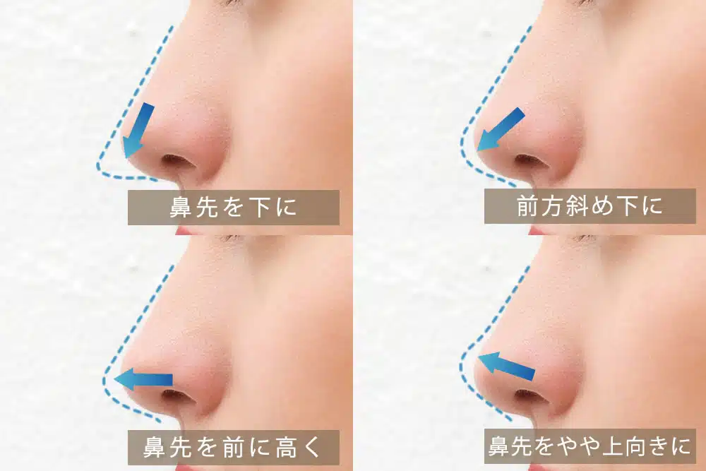 耳軟骨を鼻に挿入するデザイン 横浜みなとみらい