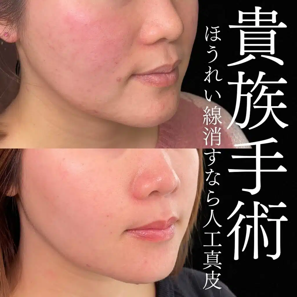貴族手術　横浜みなとみらい