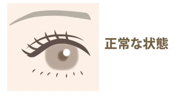 正常な目 横浜みなとみらい