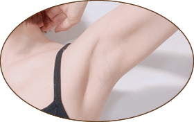 わきが治療のアイコン