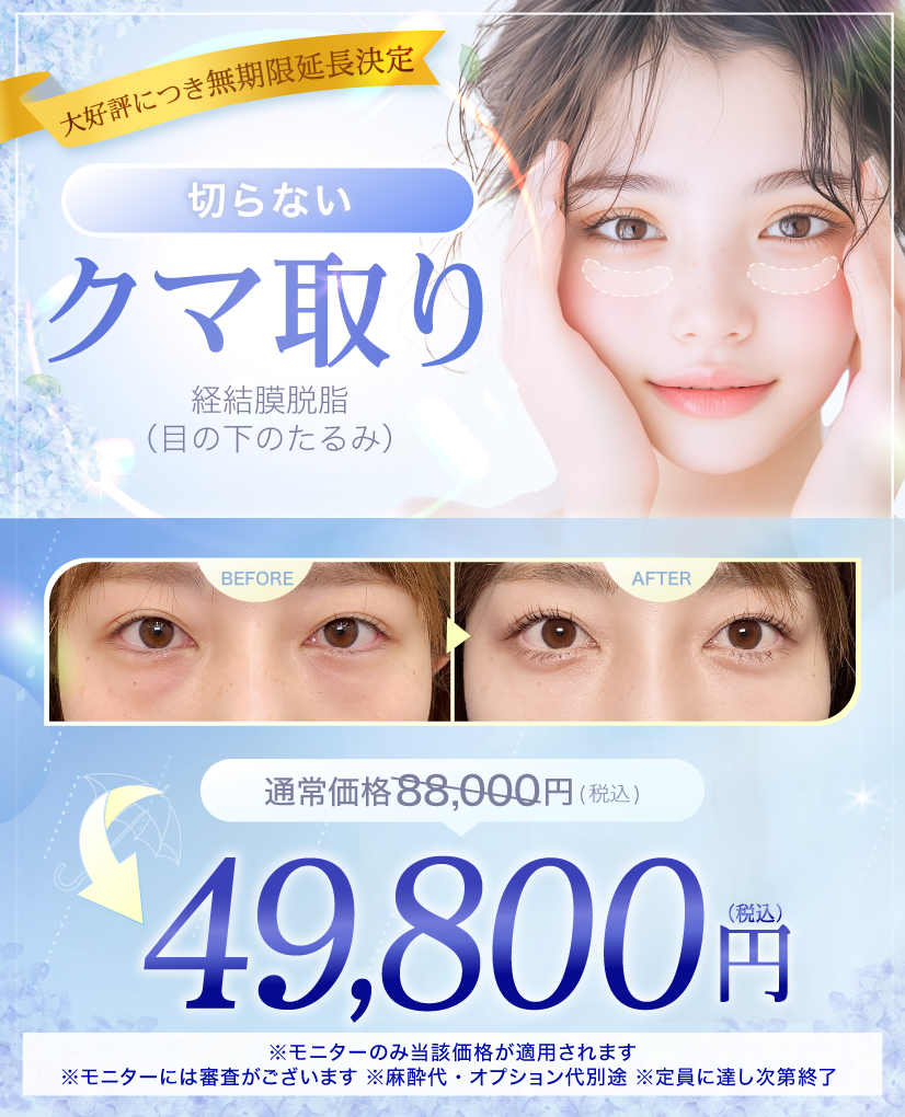 閑散期クマ取り