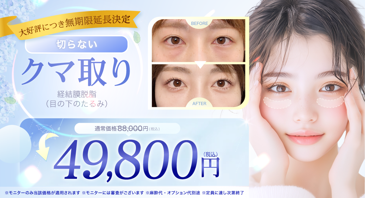 閑散期クマ取り