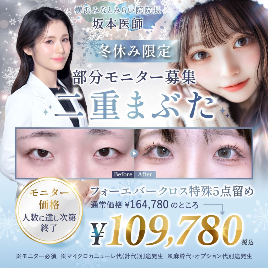 坂本医師の埋没法のキャンペーン画像sp