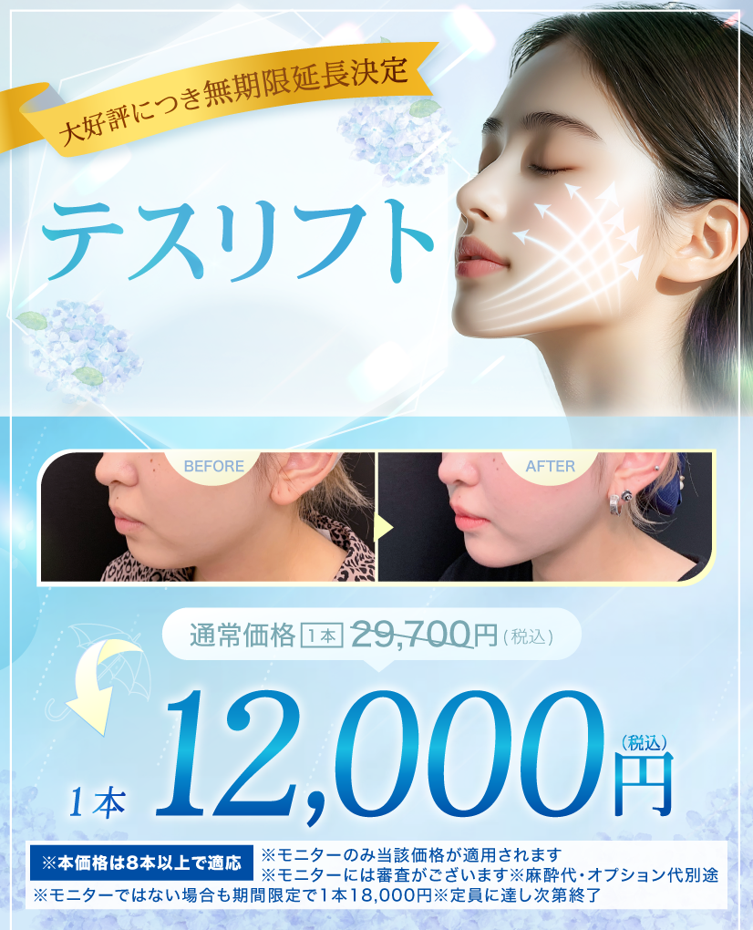 閑散期テスリフト