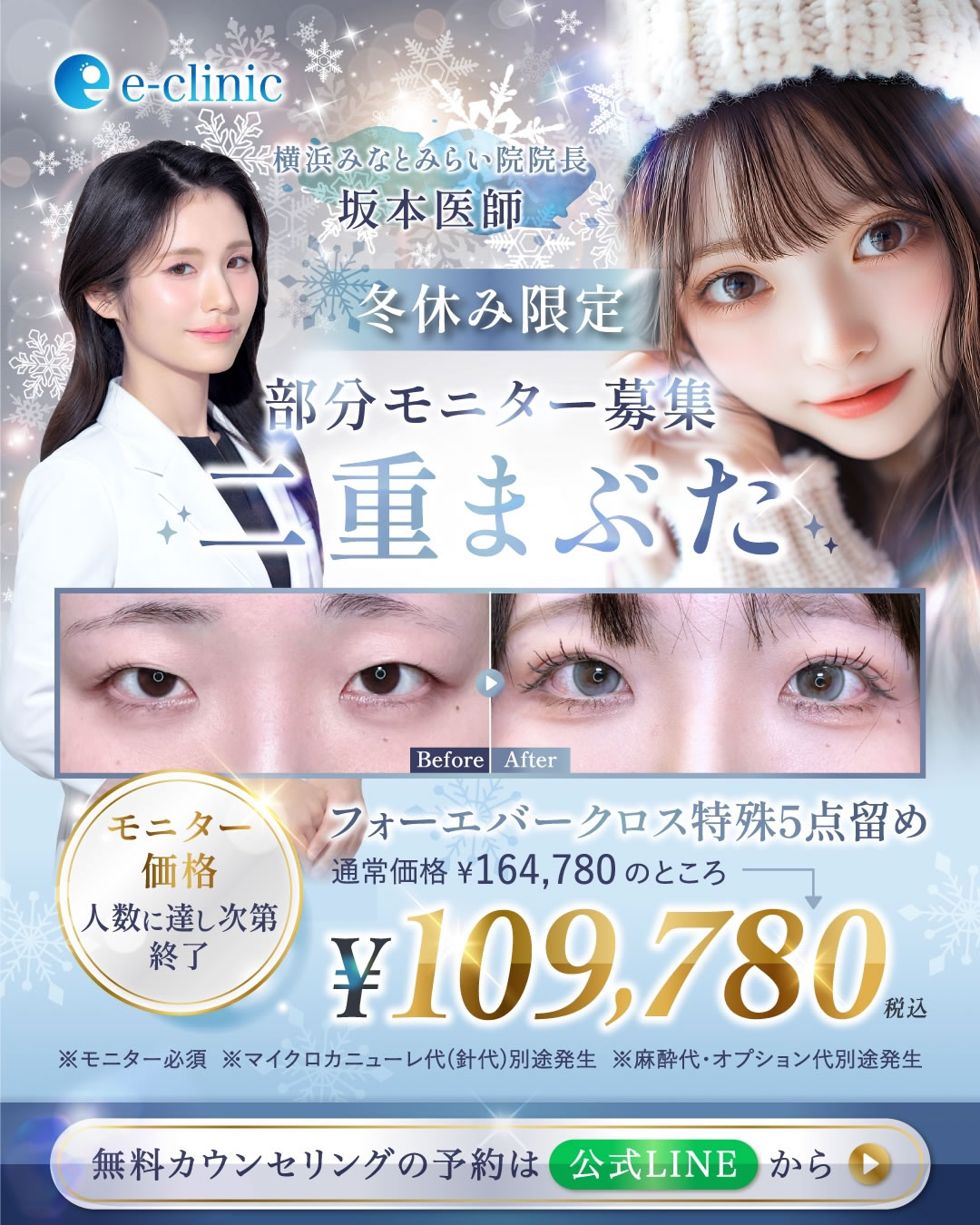 坂本医師の埋没法のキャンペーン画像