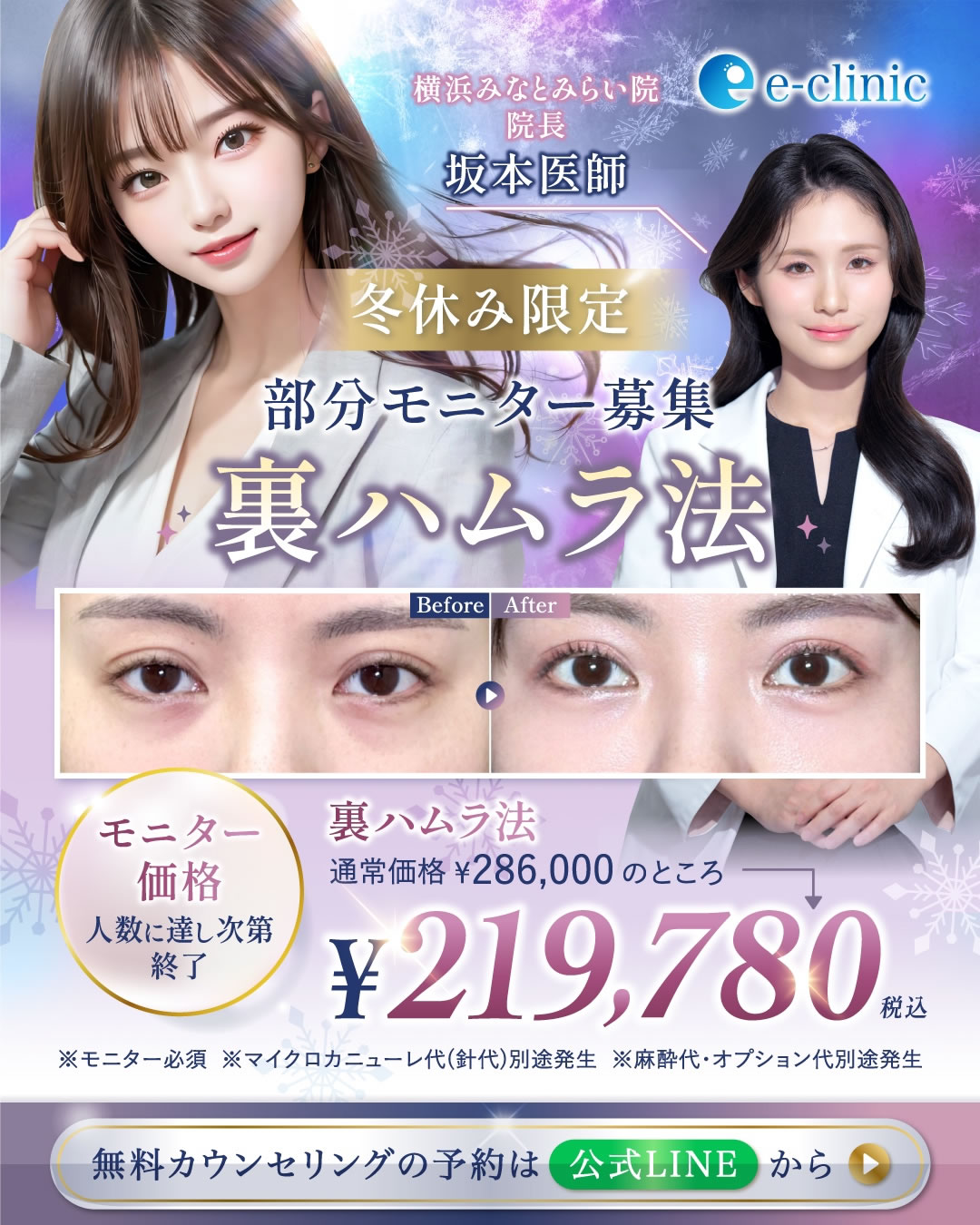 坂本医師の裏ハムラ法のキャンペーン画像