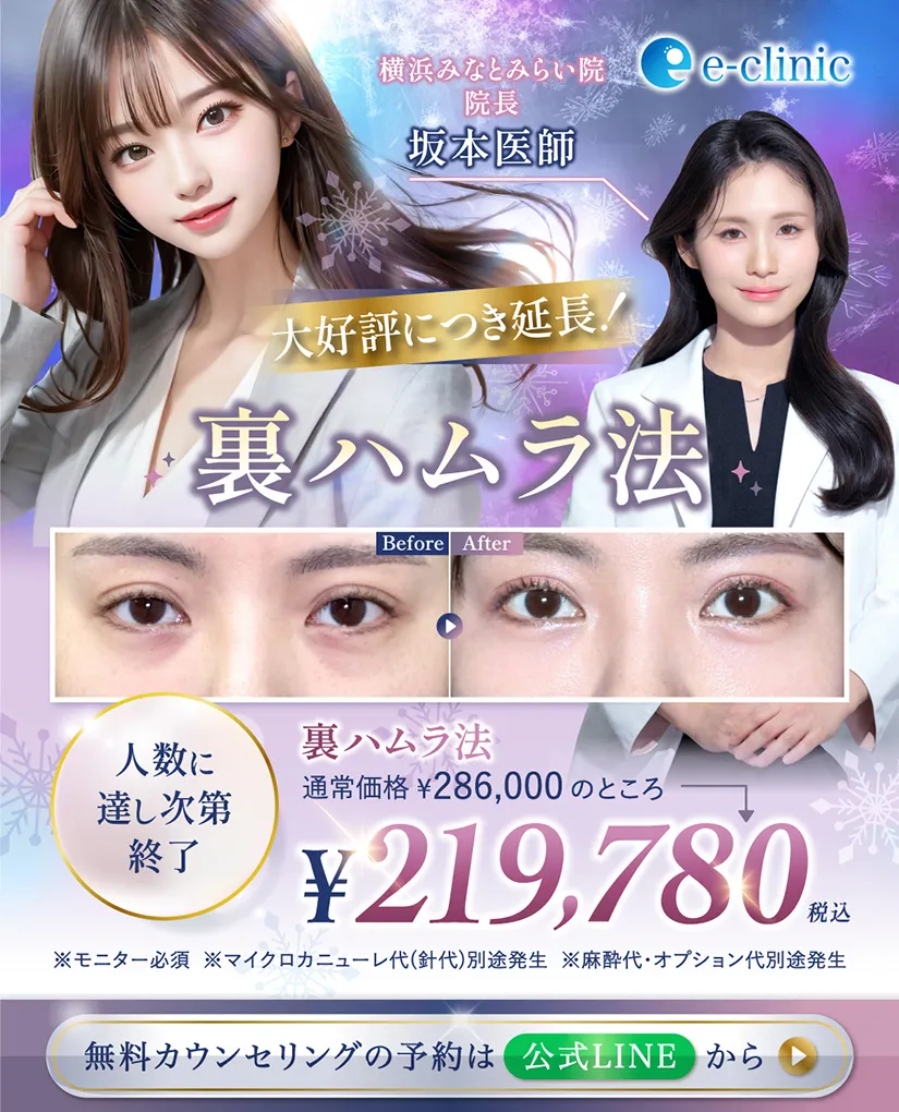 坂本医師の裏ハムラ法のキャンペーン画像