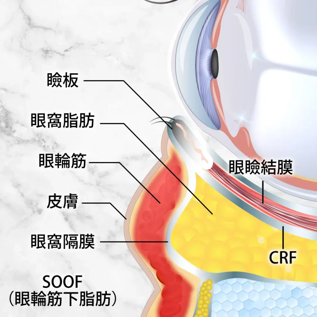 眼窩脂肪の図解