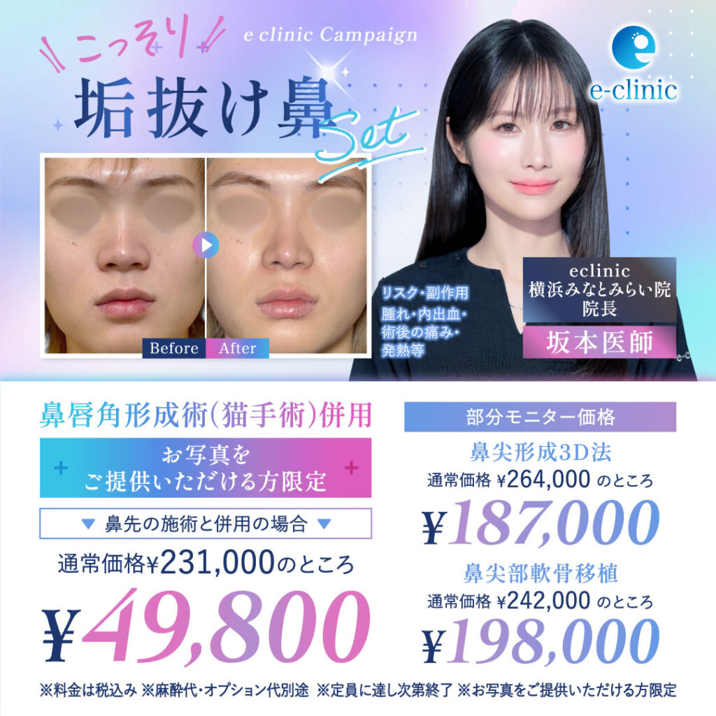 横浜みなとみらい院の坂本 優衣医師の鼻の美容整形のバナー