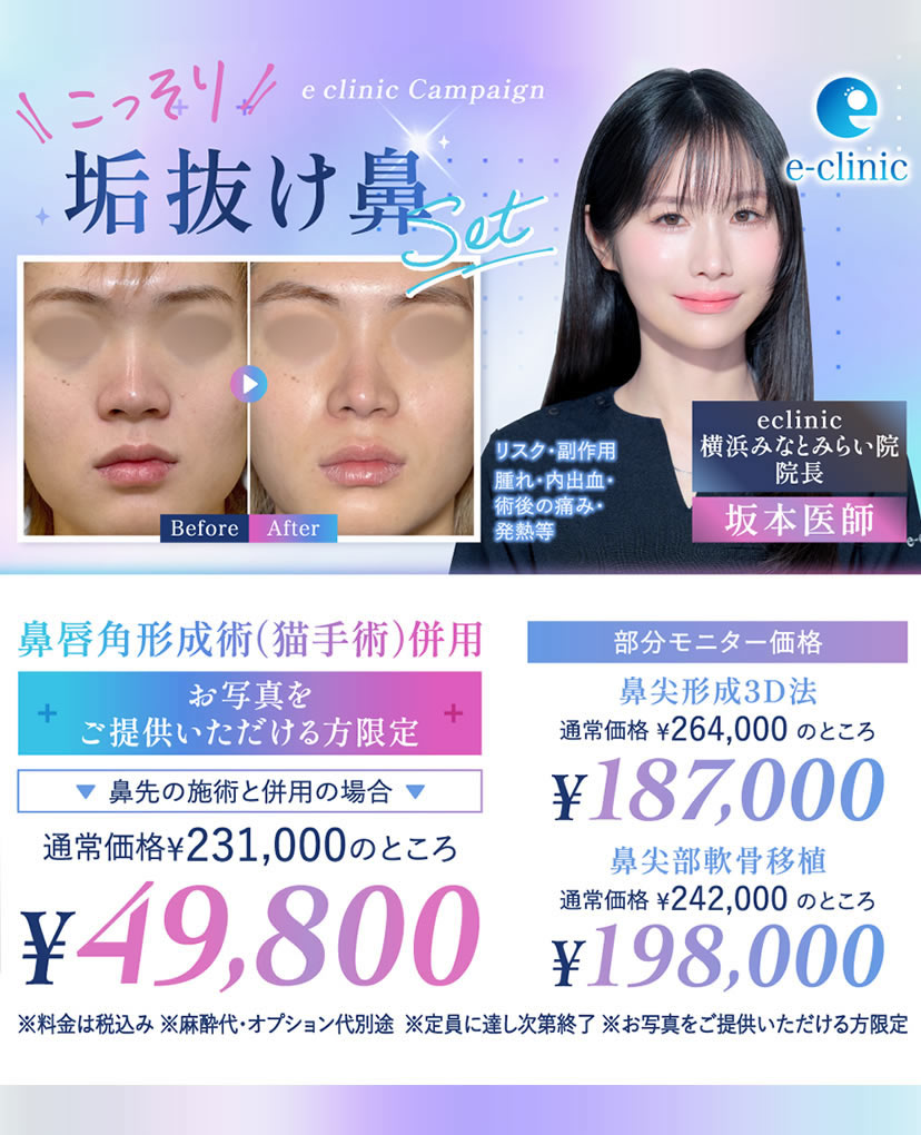 横浜みなとみらい院の坂本 優衣医師の鼻の美容整形のバナー