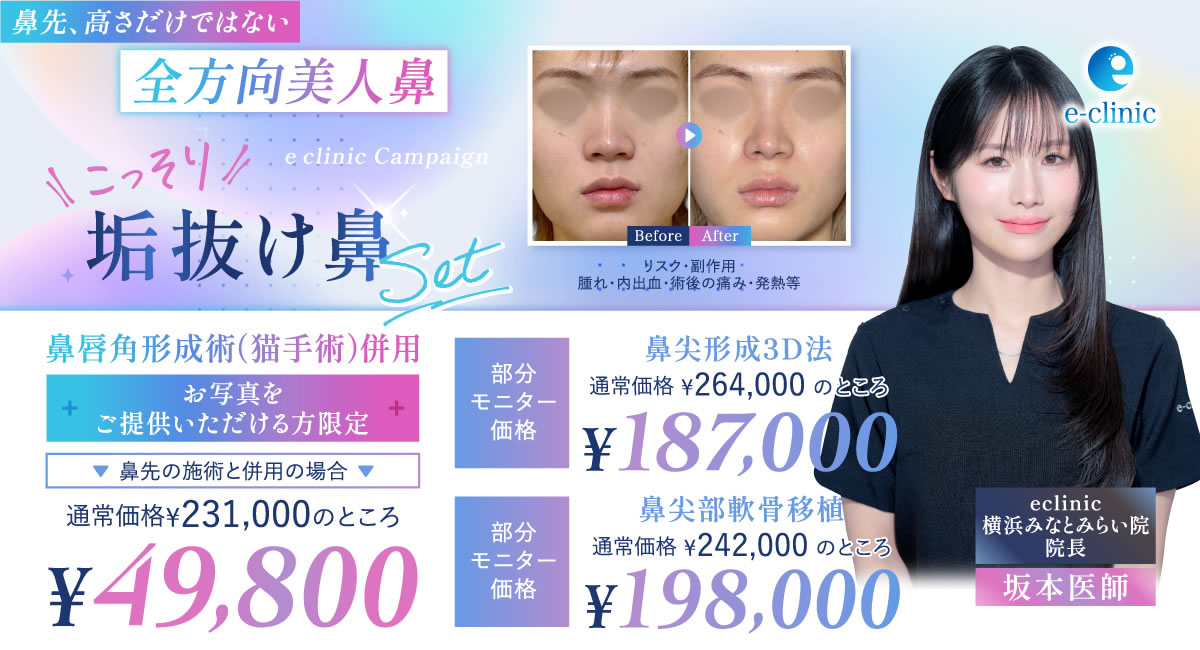 横浜みなとみらい院の坂本 優衣医師の鼻の美容整形のバナー