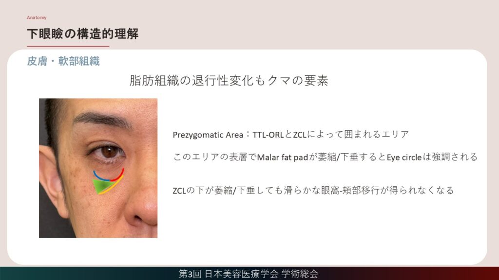 11_脂肪組織の退行性変化もクマの要素
