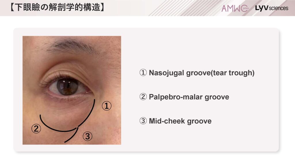 8_下眼瞼の解剖学的構造